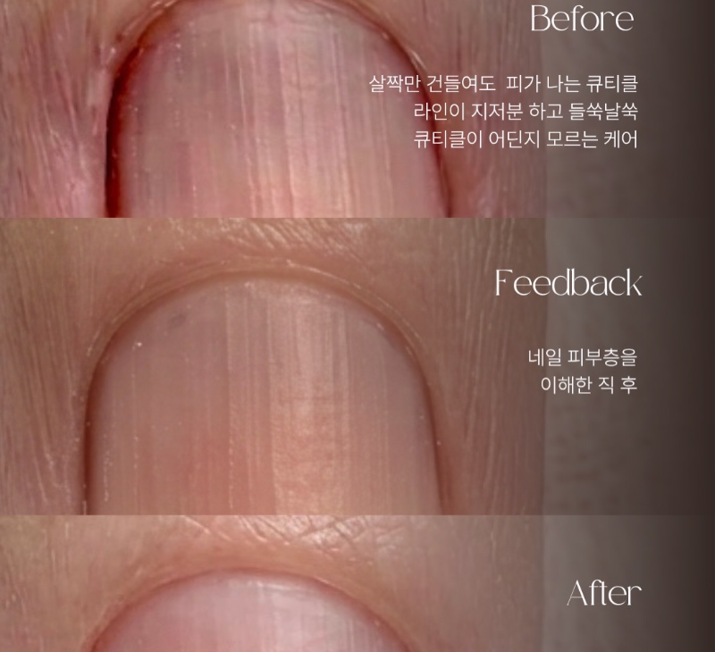 후기